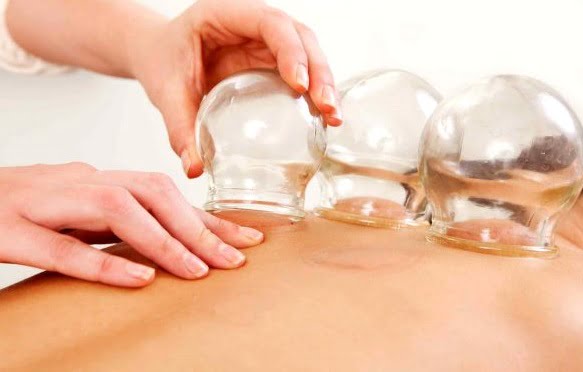 hacamatın faydaları, hacamat faydaları